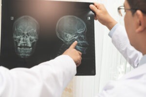 Discover how a TBI attorney in New Haven can help you recover fair