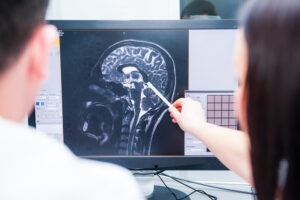 doctors checking brain MRI